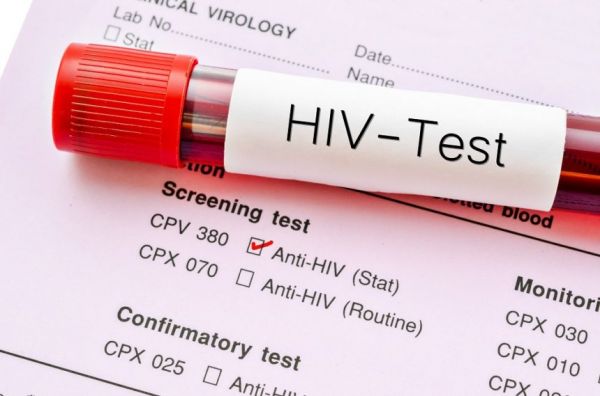 Pharmacist Expresses Concern Over HIV Figures In Ellembelle